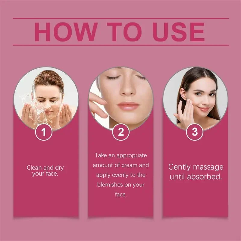 Crème blanchissante pour taches de rousseur, mélasma, taches brunes, produits d'élimination de la pigmentation, estompe les taches, répare la mélanine, illumine les soins coréens pour la peau. Nouveau