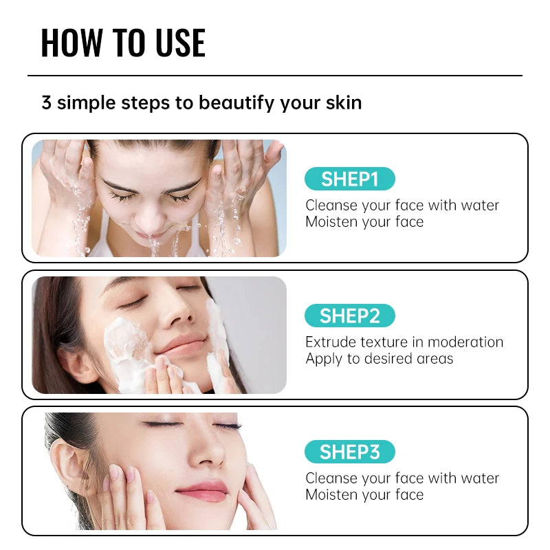 Crème anti-acné à l'acide salicylique F W, réparation anti-acné, rougeurs, boutons, nettoyage en profondeur, contrôle du sébum, soins hydratants pour la peau