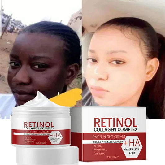 Crème blanchissante visage corps W Rétinol Collagène Acide hyaluronique 3 en 1 Élimine les taches brunes Élimine la mélanine Dissipe l'acné Éclaircit la peau