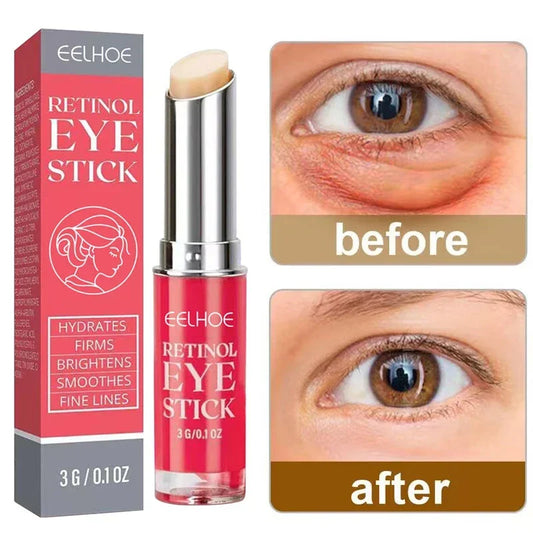 Crème contour des yeux anti-rides au rétinol, élimine les poches et les cernes, anti-âge, lifte, raffermit, blanchit, hydrate et illumine la peau.