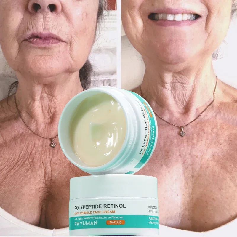 Crème visage anti-rides au rétinol FS, raffermissante, liftante, anti-âge, estompe les ridules, hydratante, blanchissante, réparatrice, soins de la peau, cosmétiques