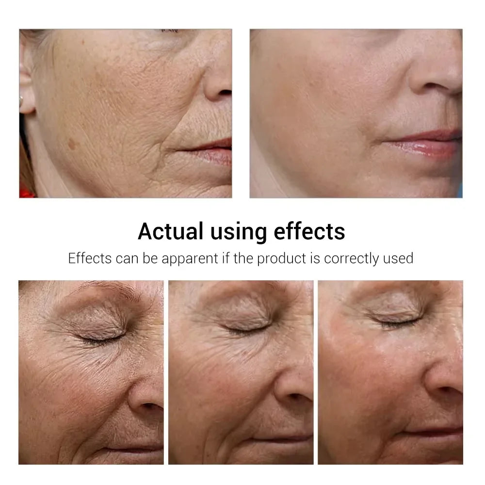 Crème visage anti-rides au rétinol FS, raffermissante, liftante, anti-âge, estompe les ridules, hydratante, blanchissante, réparatrice, soins de la peau, cosmétiques