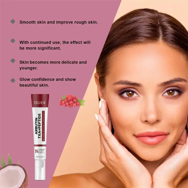 Crème blanchissante pour taches de rousseur, mélasma, taches brunes, produits d'élimination de la pigmentation, estompe les taches, répare la mélanine, illumine les soins coréens pour la peau. Nouveau