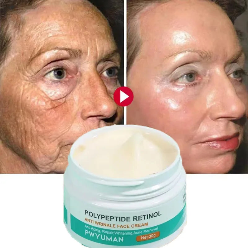 Crème visage anti-rides au rétinol FS, raffermissante, liftante, anti-âge, estompe les ridules, hydratante, blanchissante, réparatrice, soins de la peau, cosmétiques