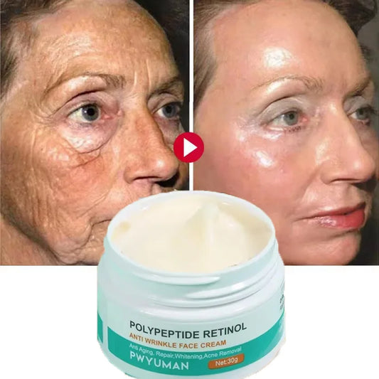 Crème visage anti-rides au rétinol FS, raffermissante, liftante, anti-âge, estompe les ridules, hydratante, blanchissante, réparatrice, soins de la peau, cosmétiques
