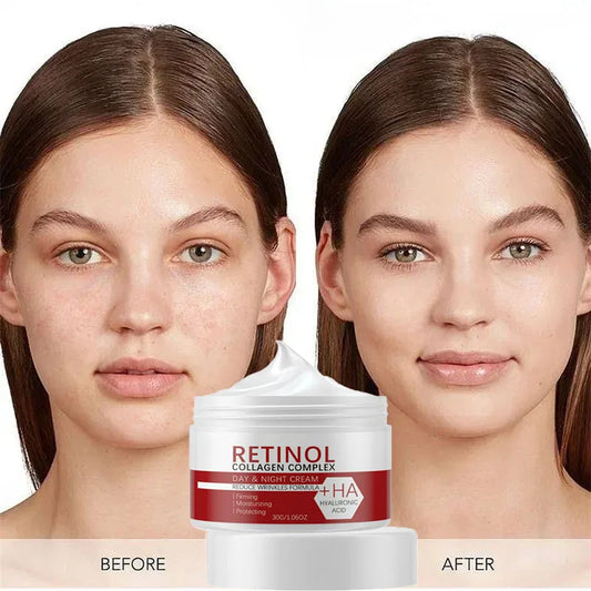 Crème blanchissante visage corps W Rétinol Collagène Acide hyaluronique 3 en 1 Élimine les taches brunes Élimine la mélanine Dissipe l'acné Éclaircit la peau