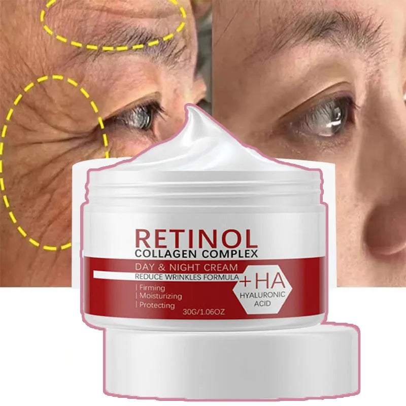 Crème blanchissante visage corps W Rétinol Collagène Acide hyaluronique 3 en 1 Élimine les taches brunes Élimine la mélanine Dissipe l'acné Éclaircit la peau
