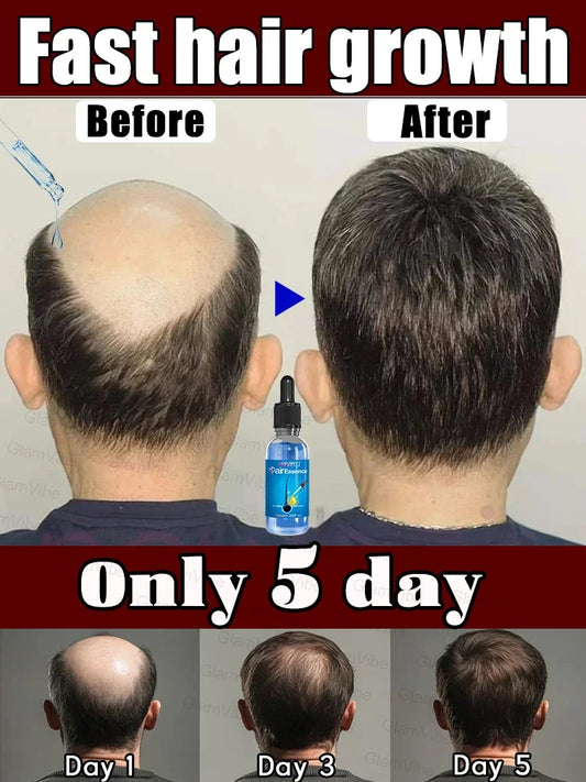 XXX WPRBREGT flacon bleu. Sérum essentiel pour la croissance des cheveux. Dites adieu à la calvitie. Le secret des cheveux épais.
