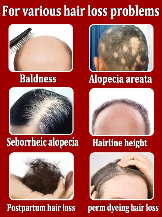 Les experts XXX ont certifié le produit le plus efficace pour la croissance capillaire. Dites adieu à la calvitie en 7 jours. Également efficace pour la barbe et les cheveux.