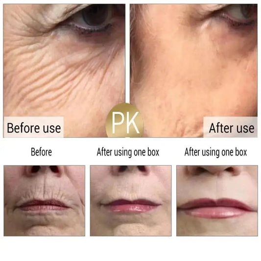 Crème visage anti-rides au rétinol FS, raffermissante, liftante, anti-âge, estompe les ridules, hydratante, blanchissante, réparatrice, soins de la peau, cosmétiques