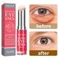Crème contour des yeux anti-rides au rétinol, élimine les poches et les cernes, anti-âge, lifte, raffermit, blanchit, hydrate et illumine la peau.