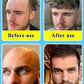 Les experts XXX ont certifié le produit le plus efficace pour la croissance capillaire. Dites adieu à la calvitie en 7 jours. Également efficace pour la barbe et les cheveux.
