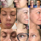 Crème blanchissante pour taches de rousseur, mélasma, taches brunes, produits d'élimination de la pigmentation, estompe les taches, répare la mélanine, illumine les soins coréens pour la peau. Nouveau