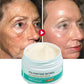 Crème visage anti-rides au rétinol FS, raffermissante, liftante, anti-âge, estompe les ridules, hydratante, blanchissante, réparatrice, soins de la peau, cosmétiques